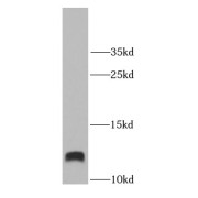 WB analysis of PC-3 cells, using S100A11 antibody (1/1000 dilution).