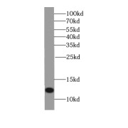 WB analysis of HeLa cells, using S100A11 antibody (1/1000 dilution).