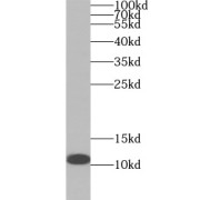 WB analysis of HeLa cells, using S100A3 antibody (1/500 dilution).