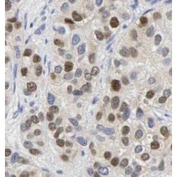 Protein S100-A4 (S100A4) Antibody