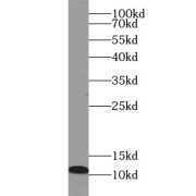 WB analysis of HeLa cells, using S100A4 antibody (1/1000 dilution).