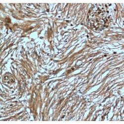 S100 Calcium Binding Protein A5 (S100A5) Antibody