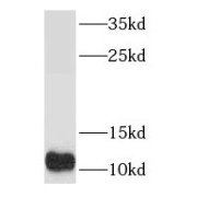 WB analysis of HepG2 cells, using S100A5 antibody (1/500 dilution).