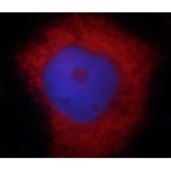 S100 Calcium Binding Protein A6 (S100A6) Antibody