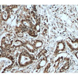 S100 Calcium Binding Protein A6 (S100A6) Antibody