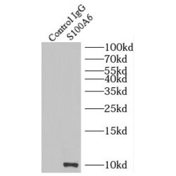 S100 Calcium Binding Protein A6 (S100A6) Antibody