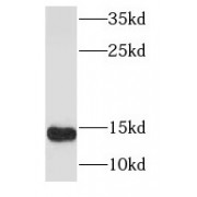 WB analysis of human heart tissue, using S100A9 antibody (1/500 dilution).