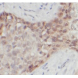 S100 Calcium Binding Protein B (S100B) Antibody