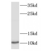 WB analysis of HeLa cells, using S100P antibody (1/1000 dilution).