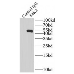 Ribosomal Protein S6 Kinase Beta-2 (RPS6KB2) Antibody