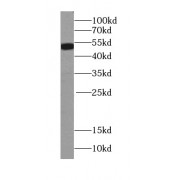 WB analysis of MCF7 cells, using S6K2 antibody (1/1500 dilution).