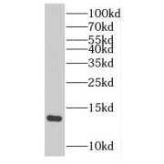 WB analysis of Rat liver tissue, using SAA1 antibody (1/1000 dilution).