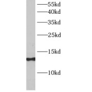 WB analysis of HeLa cells, using SAA4 antibody (1/1000 dilution).