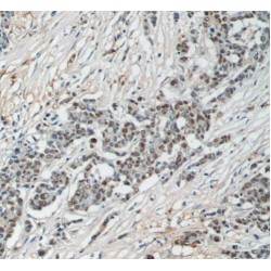 SUMO-Activating Enzyme Subunit 1 (SAE1) Antibody