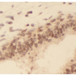 Scaffold Attachment Factor B (SAFB) Antibody