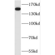 WB analysis of MCF-7 cells, using SAFB antibody (1/1000 dilution).