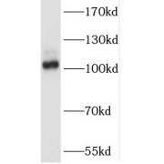 WB analysis of HEK-293 cells, using SALL2 antibody (1/300 dilution).