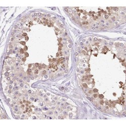 Sal-Like Protein 4 (SALL4) Antibody