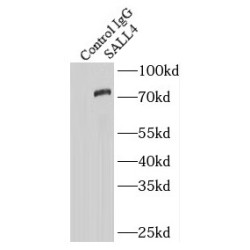 Sal-Like Protein 4 (SALL4) Antibody