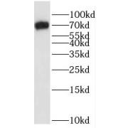 WB analysis of HepG2 cells, using SALL4 antibody (1/1000 dilution).