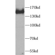 WB analysis of K-562 cells, using SALL4 antibody (1/1000).