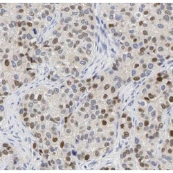 Sam68 Antibody