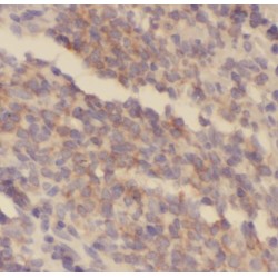 Sterile Alpha Motif Domain Containing 4A (SAMD4A) Antibody