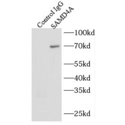 Sterile Alpha Motif Domain Containing 4A (SAMD4A) Antibody