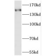 WB analysis of HeLa cells, using SAMD9 antibody (1/1000 dilution).