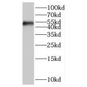 WB analysis of mouse ovary tissue, using SAMM50 antibody (1/400 dilution).