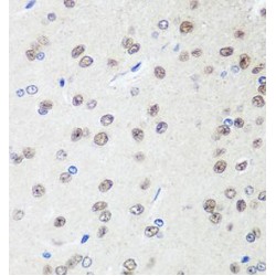 Synaptosomal-Associated Protein 18 (SAP18) Antibody