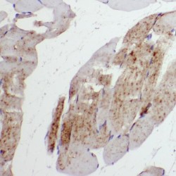 Secretion Associated Ras Related GTPase 1A (SAR1A) Antibody