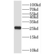 WB analysis of mouse liver tissue, using SAR1B antibody (1/500 dilution).