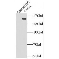 Zinc Finger FYVE Domain-Containing Protein 9 (ZFYVE9) Antibody