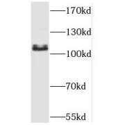 WB analysis of HeLa cells, using SART1 antibody (1/1000 dilution).