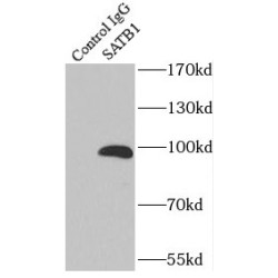 SATB Homeobox 1 (SATB1) Antibody