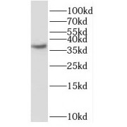 WB analysis of mouse brain tissue, using SCAMP1 antibody (1/1500 dilution).