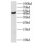 WB analysis of COLO 320 cells, using SCCPDH antibody (1/1000 dilution).
