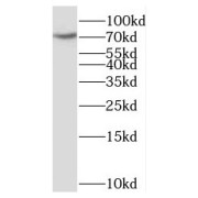 WB analysis of mouse cerebellum tissue, using SCLT1 antibody (1/300 dilution).