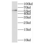 WB analysis of human lung tissue, using SCMH1 antibody (1/500 dilution).
