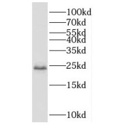 WB analysis of HepG2 cells, using SCML1 antibody (1/400 dilution).