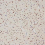 IHC-P analysis of human brain tissue, using SCNM1 antibody (1/50 dilution).