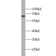 WB analysis of PC-13 cells, using SCNN1A antibody (1/600 dilution).