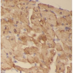 SCO2, Cytochrome C Oxidase Assembly Protein (SCO2) Antibody