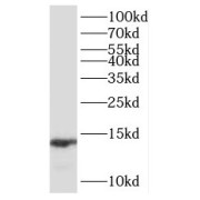 WB analysis of HepG2 cells, using SCP2 antibody (1/500 dilution).