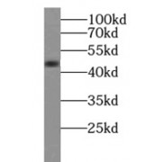 WB analysis of A549 cells, using SCRN1 antibody (1/300 dilution).