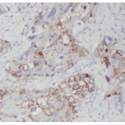 SDCCAG1 Antibody