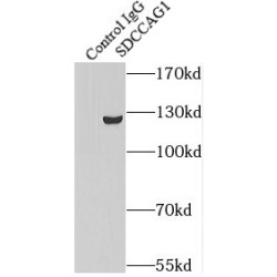 SDCCAG1 Antibody