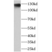 WB analysis of A549 cells, using SDCCAG1 antibody (1/500 dilution).