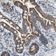 IHC-P analysis of human colon tissue, using SDF4 Antibody (1/50 dilution).